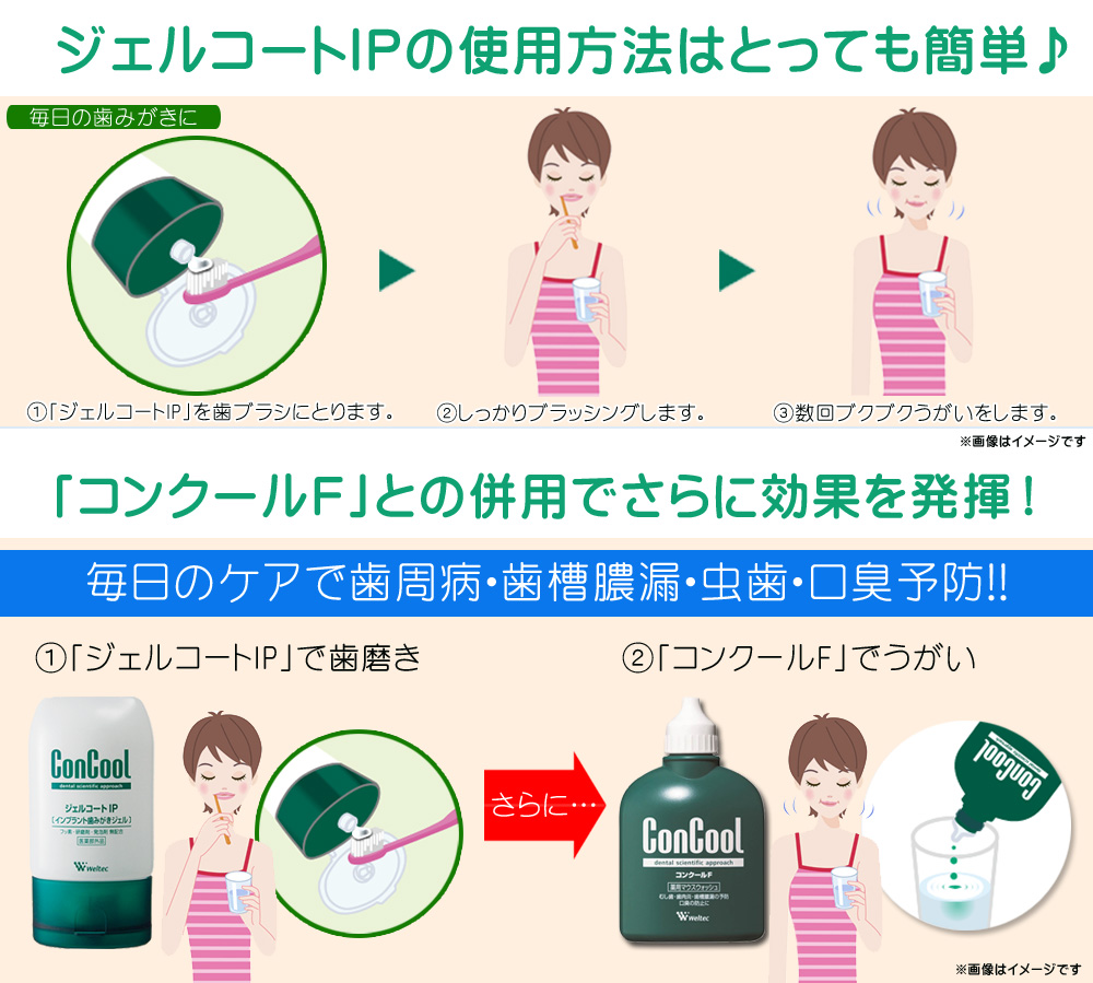 楽天市場】コンクール ジェルコートIP 90g 医薬部外品歯科専売品 