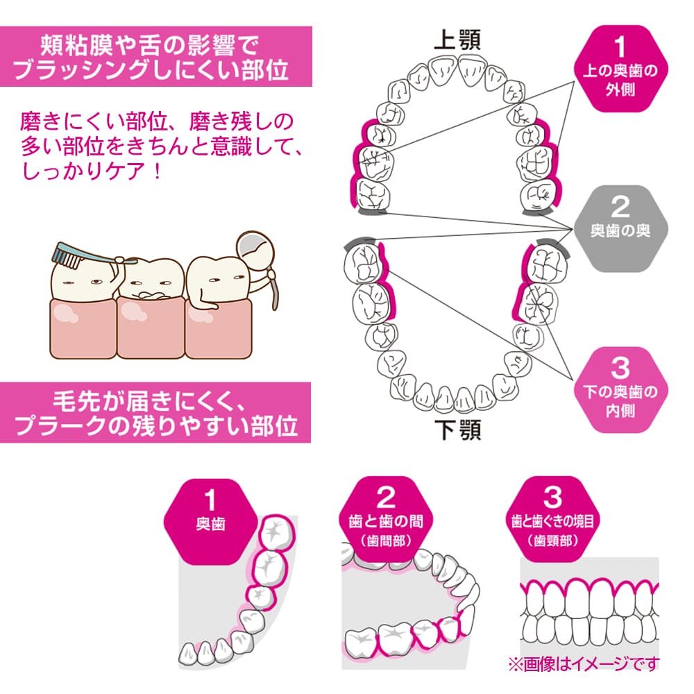 ライオン システマ AX 歯ブラシ 12本歯科専売 歯科用 歯ブラシ ハブラシ LION ライオン DENT. Systema AX システマAX 歯周 ケア